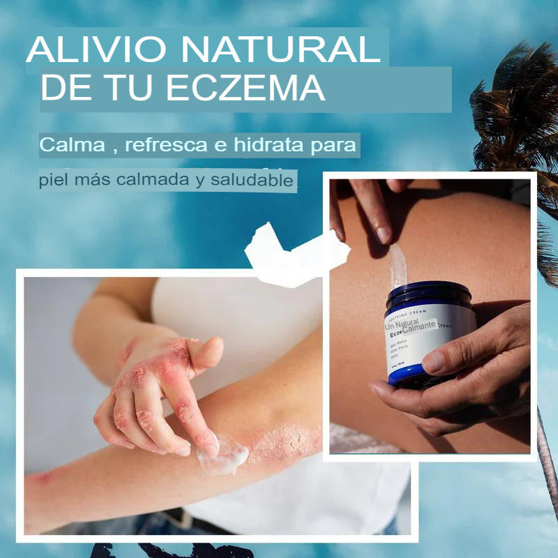 Crema calmante para el eczema totalmente natural The Ocean curó mi eczema