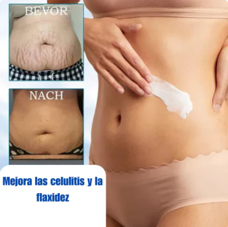 ✨🩵𝟕𝟎% 𝐎𝐅𝐅🌸𝐅𝐮𝐛𝐬𝐭𝐚® -Recupera la elasticidad de la piel⭐ 300ML