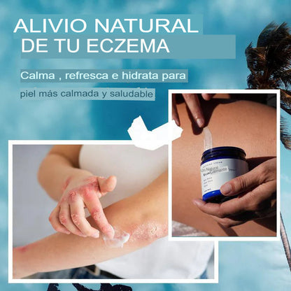 Crema calmante para el eczema totalmente natural The Ocean curó mi eczema