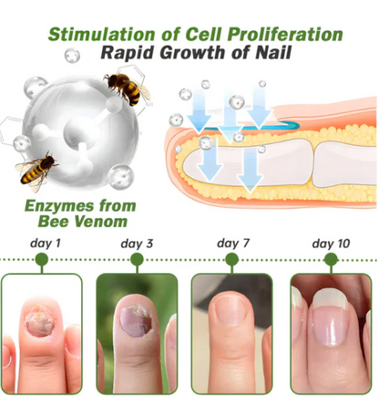 Flysmus - Suero para tratamiento de uñas con veneno de abeja OFERTA 2X1  ✅