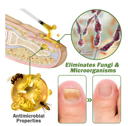 Flysmus - Suero para tratamiento de uñas con veneno de abeja OFERTA 2X1  ✅
