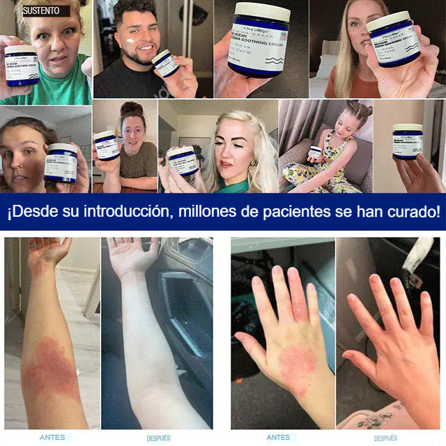 Crema calmante para el eczema totalmente natural The Ocean curó mi eczema